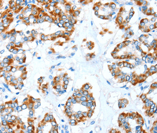 ALDH5A1 Polyclonal Antibody (E-AB-16147)