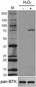 Purified anti-BTK Phospho (Tyr 223) Antibody (601701)