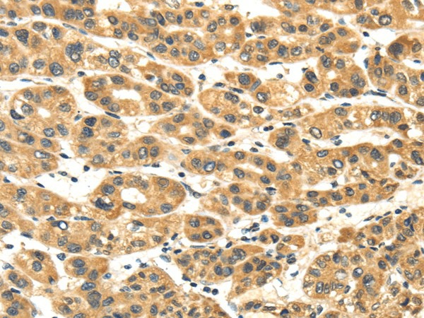 NME8 Polyclonal Antibody (E-AB-17177)