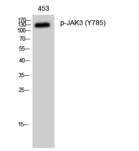 Phospho-JAK3 (Tyr785) Polyclonal Antibody (E-AB-21215)