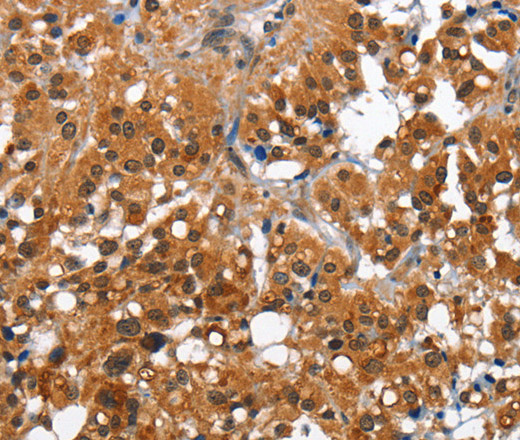 CAMK1D Polyclonal Antibody (E-AB-11024)