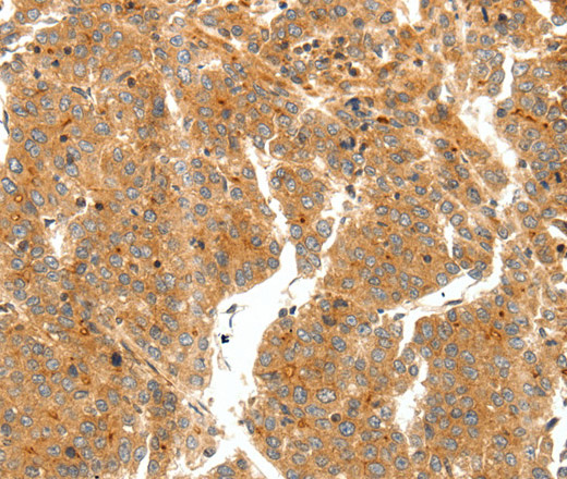 SCT Polyclonal Antibody (E-AB-16056)
