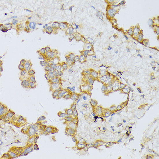 ART1 Polyclonal Antibody (E-AB-65734)