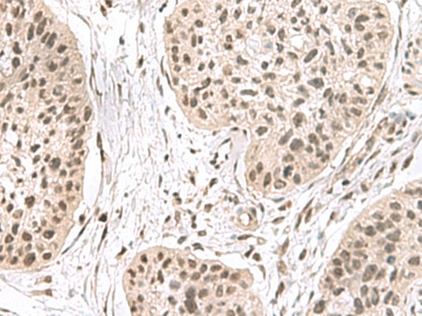 ERH Polyclonal Antibody (E-AB-53016)