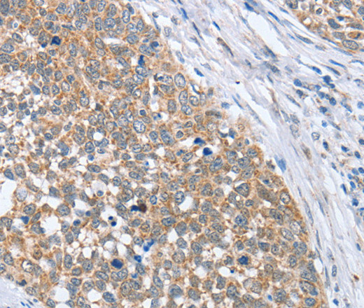 PAPSS1 Polyclonal Antibody (E-AB-10886)