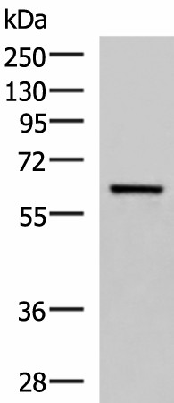 SARS Polyclonal Antibody (E-AB-19068)