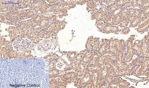 CD10 Monoclonal Antibody (E-AB-22153)