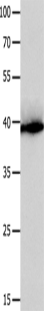 CFHR1 Polyclonal Antibody (E-AB-14120)