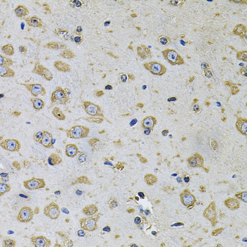RhoA Polyclonal Antibody (E-AB-64876)