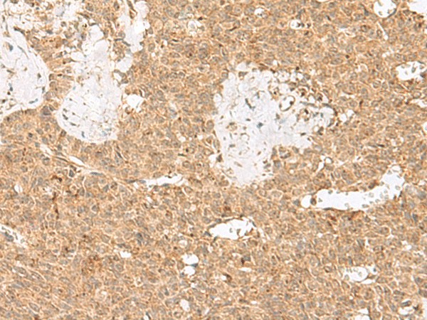 LGALSL Polyclonal Antibody (E-AB-19969)