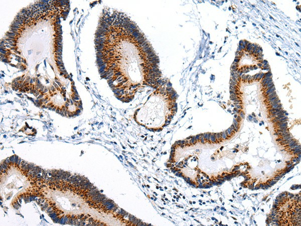 ARFGAP2 Polyclonal Antibody (E-AB-17647)