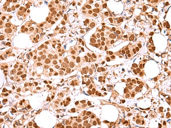 RCOR3 Polyclonal Antibody (E-AB-19039)