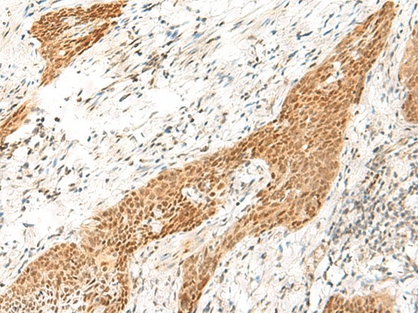 RPS27A Polyclonal Antibody (E-AB-52819)