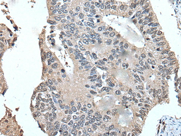 UFM1 Polyclonal Antibody (E-AB-18507)