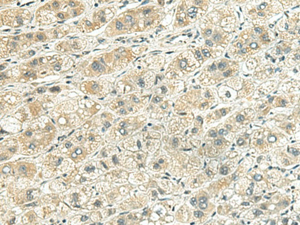 RHBDL2 Polyclonal Antibody (E-AB-53024)
