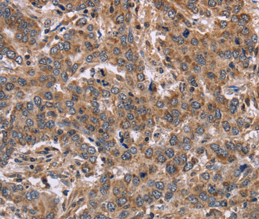 FAAH2 Polyclonal Antibody (E-AB-15005)