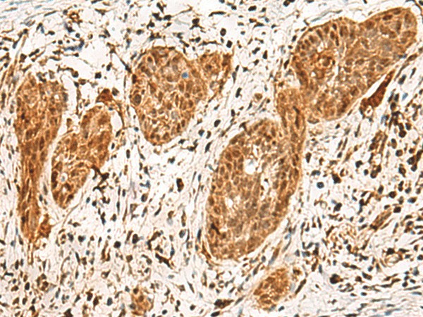 POLR1E Polyclonal Antibody (E-AB-52742)