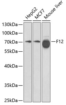 F12 Polyclonal Antibody (E-AB-60412)