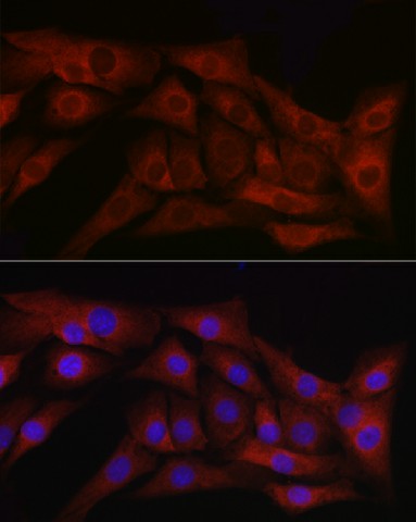 TGFB1 Polyclonal Antibody (E-AB-66425)