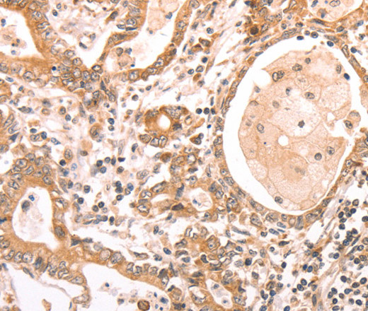 ABCF1 Polyclonal Antibody (E-AB-14461)