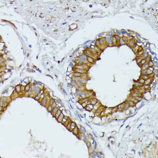 WNT1 Polyclonal Antibody (E-AB-67464)