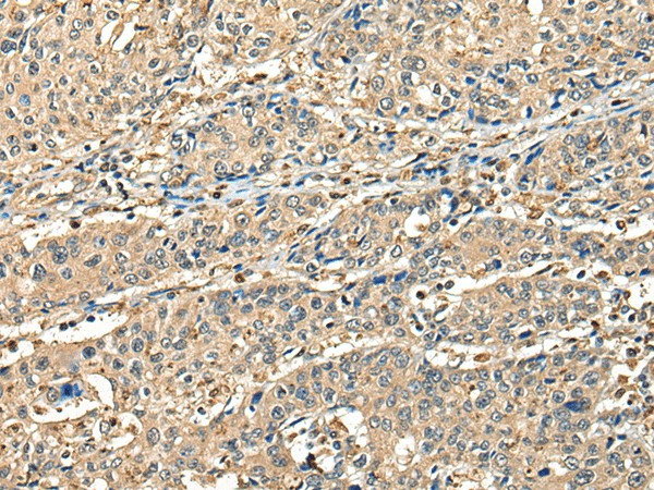 CCDC112 Polyclonal Antibody (E-AB-18588)