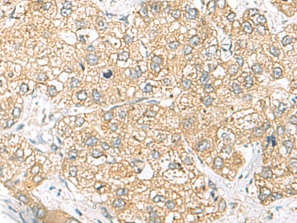 SH3GL2 Polyclonal Antibody (E-AB-52593)