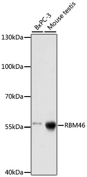RBM46 Polyclonal Antibody (E-AB-66872)