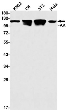 Recombinant FAK Monoclonal Antibody (E-AB-81468)