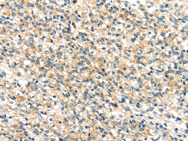 TTI1 Polyclonal Antibody (E-AB-17482)