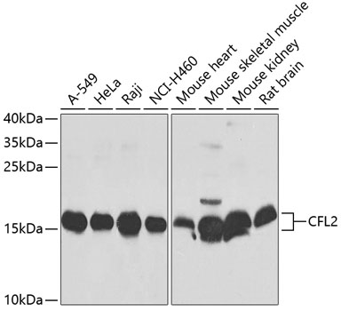 CFL2 Polyclonal Antibody (E-AB-62037)