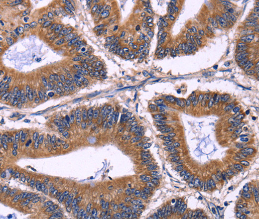 KIR2DL1/3/4/S4 Polyclonal Antibody (E-AB-14837)