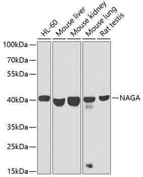 NAGA Polyclonal Antibody (E-AB-62840)