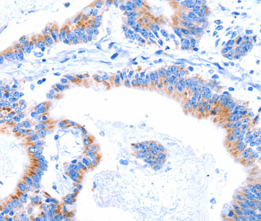 SMG8 Polyclonal Antibody (E-AB-12757)