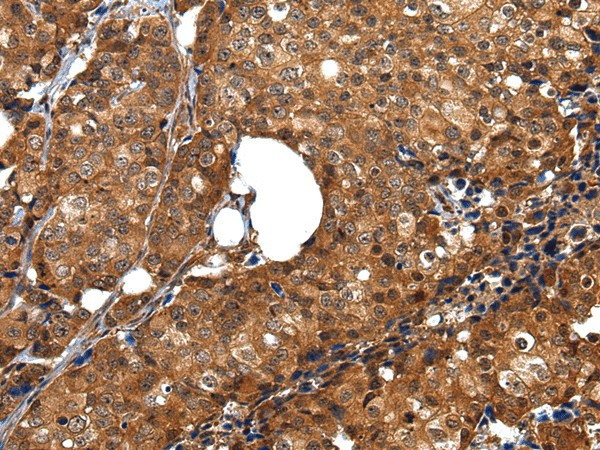 ZBTB2 Polyclonal Antibody (E-AB-17637)