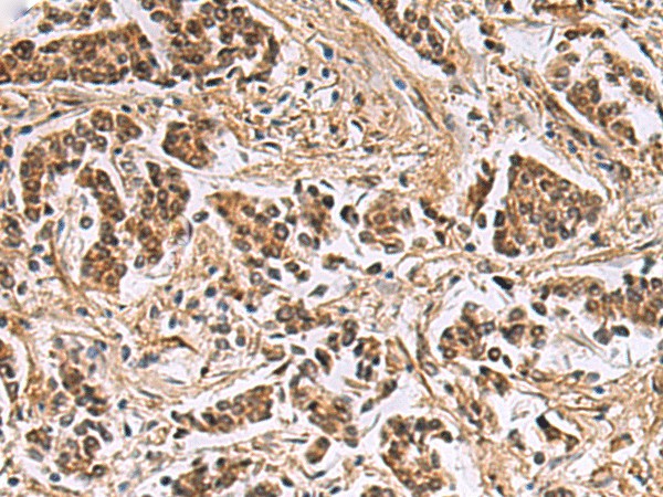 DNA2 Polyclonal Antibody (E-AB-19275)
