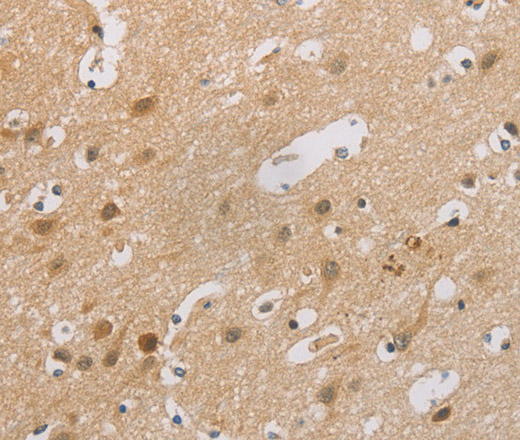 p16 Polyclonal Antibody (E-AB-13142)