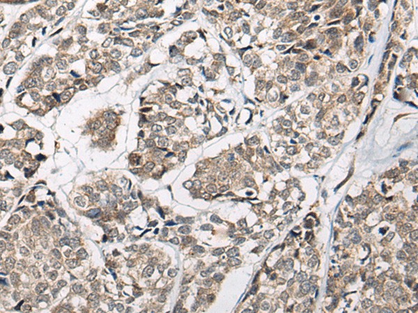 CACNB3 Polyclonal Antibody (E-AB-17758)