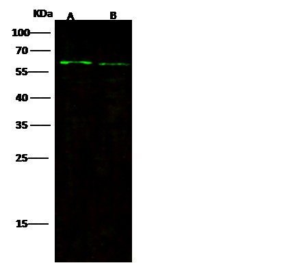 Recombinant FGFRL1/FGFR5 Monoclonal Antibody (AN300489P)