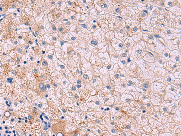 JAM3 Polyclonal Antibody (E-AB-18148)