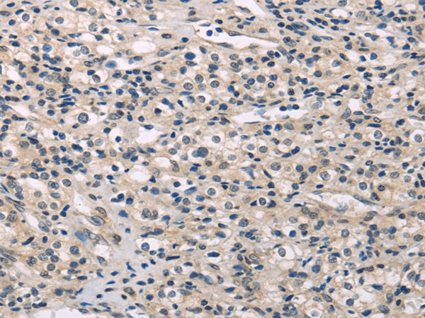 MED28 Polyclonal Antibody (E-AB-17141)