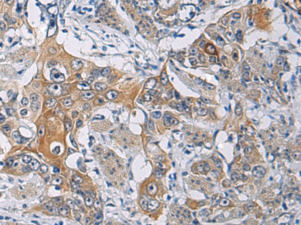 KCNJ10 Polyclonal Antibody (E-AB-19262)
