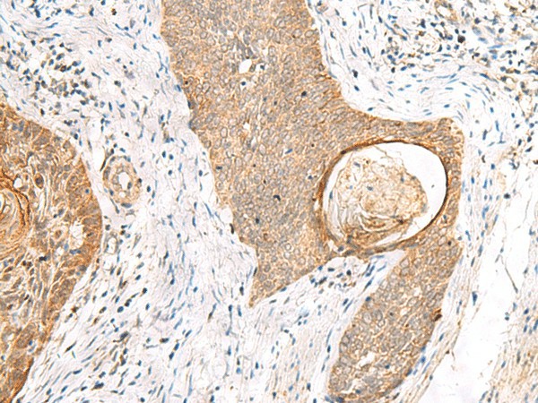 TOR1A Polyclonal Antibody (E-AB-18794)