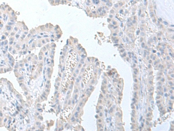 STAU2 Polyclonal Antibody (E-AB-52678)