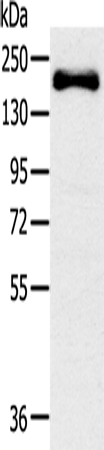 SLIT2 Polyclonal Antibody (E-AB-13664)