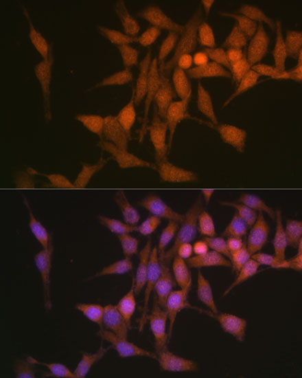 PSMB6 Polyclonal Antibody (E-AB-63773)