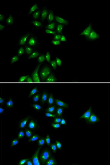 PHC3 Polyclonal Antibody (E-AB-66227)