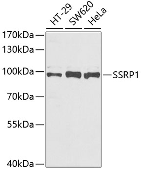 SSRP1 Polyclonal Antibody (E-AB-61945)