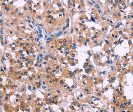 DUSP13 Polyclonal Antibody (E-AB-14067)