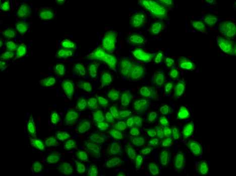 FBXO7 Polyclonal Antibody (E-AB-61724)